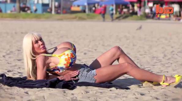 Огромни гърди-убийци застрашават живота на тази жена (ВИДЕО)