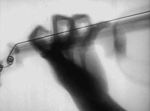 Вижте как се движи тялото ни на рентген (GIF-чета)