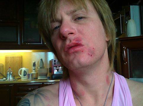 Жертвите на родния Ханибал проговарят: Измъчваше ни в Къщата на ужасите!