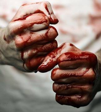 Кървав Трифон Зарезан: Млад мъж със счупен череп и избити зъби с метален бокс