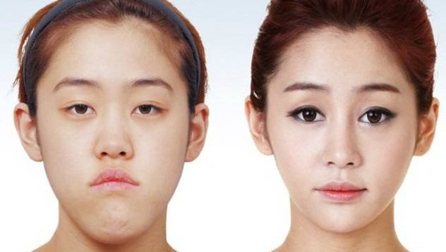 Неузнаваеми след пластични операции (снимки) видяна 8937 коментари 11