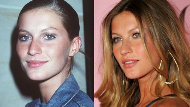 Добрият пример: Ринопластиката на Жизел Бюндхен видяна 2657 коментари 2