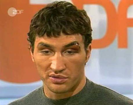 Владимир Кличко разкрит! Ето защо бягаше от мач с Кобрата!