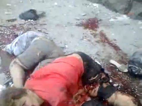 Покъртителен разказ за смъртта на жената с откъснатите от украинска бомба крака в Луганск (ВИДЕО 18+)