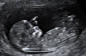 Седмица 11 от бременността