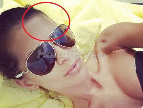 Преслава си показа синините след боя с Бирмата! Пусна снимка във Фейсбук!