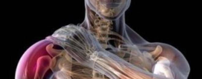 Упражнения за облекчаване на болката при плексит