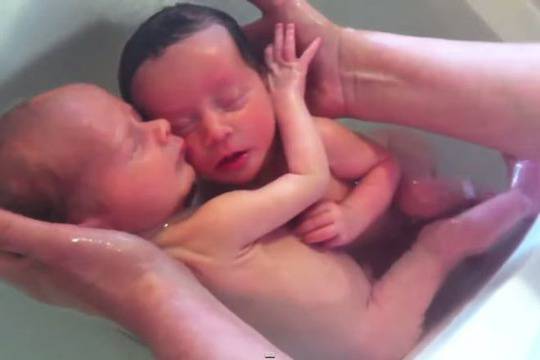 Близнаци не разбират, че са се родили