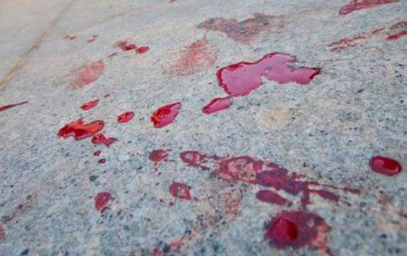 Отрязаха със сабя ухото на шеф на ББЦ в Козлодуй