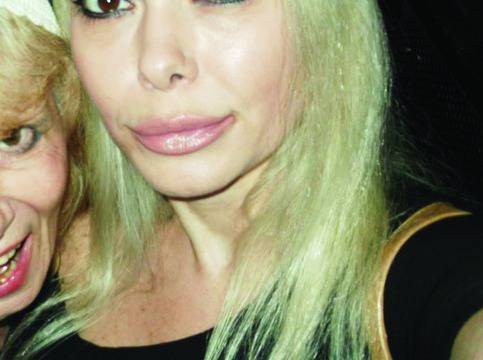 Албена Вулева не прилича на себе си! Обезобрази лицето си!!