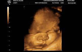 Седмица 39 от бременността