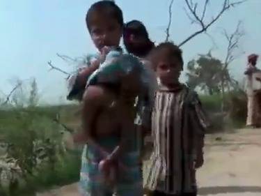 Дете се роди с 4 ръце и 4 крака!