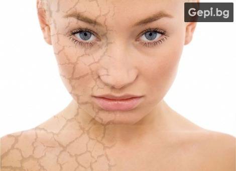 Фототерапия PTF за лечение на спукани капиляри.