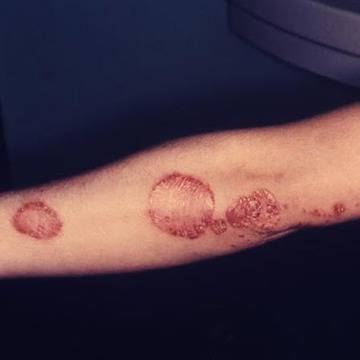 Отслабване с диета и фитнес