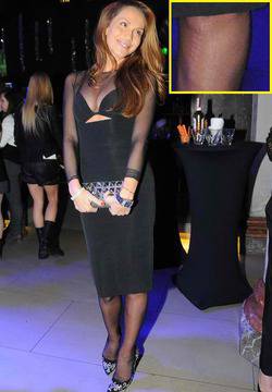 Ивайла Бакалова ляга под ножа! Вижте какво ще си оперира!