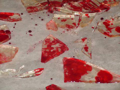 Момче си преряза гърлото с парче огледало