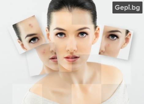 Лечение на акне на лице чрез фототерапия!