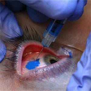 Нова мода – тату в окото (видео) 1 3117