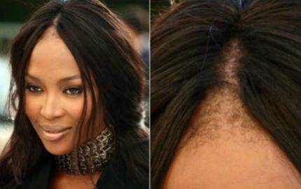 Наоми Кембъл престана да маскира оплешивяването си (галерия)