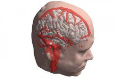 С имплантирани в мозъка електроди ще лекуват анорексия