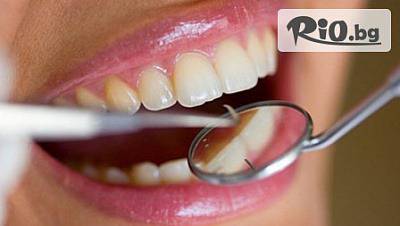 Почистване На Зъбен Камък С Ултразвук, Полиране На Зъбите С Четка И Паста Или Фотополимерна Пломба С Високоестетичния…