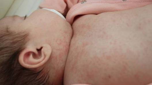 Баби едва не убиха бебе с домашни рецепти за сваляне на температура!