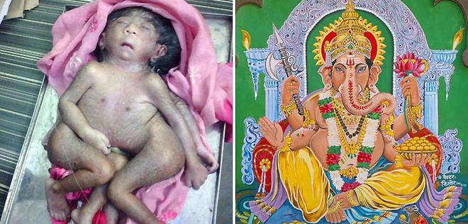 Роди се дете с 8 крайника! Обявиха го за бог!