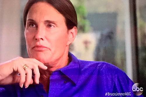 Трансджендър-защо има такива хора?