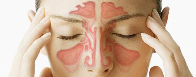 Лечение на синузит по стари народни рецепти