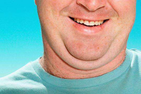 Как да се отървем от двойната брадичка?