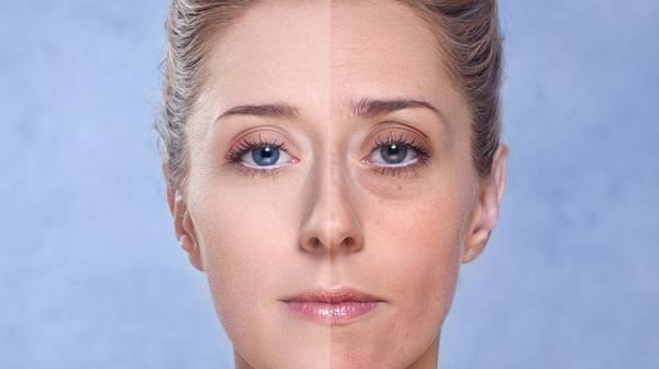 За пигментните петна по кожата. Защо се появяват и как да се борим с тях?