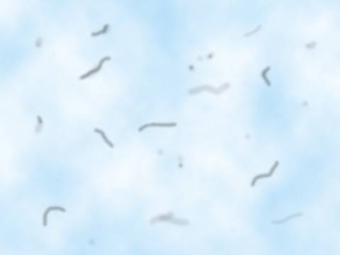 Какво причинява “плаващите мътнини” в очите?