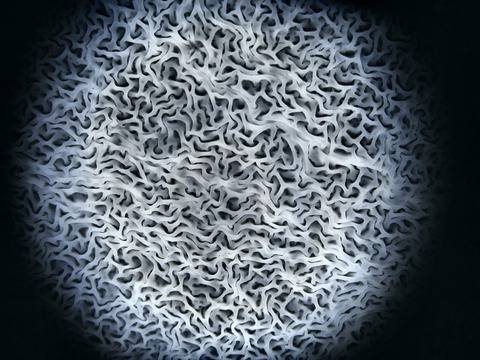 Премахване на кокоши трън с метода “2 в 1″