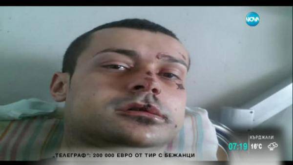 Пребито момче търси помощ чрез социалните мрежи