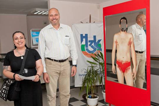 НЗОК планира да осигури средства за домашно лечение на пациентите с гноен хидраденит