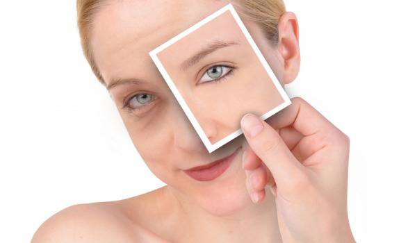 Кажете сбогом на торбичките под очите