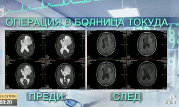 Операция на тумор или замаскирана лъжа?