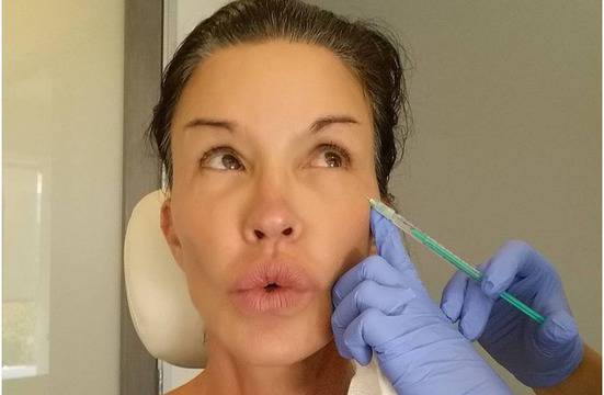 Ботокс селфи: Джанис Дикинсън