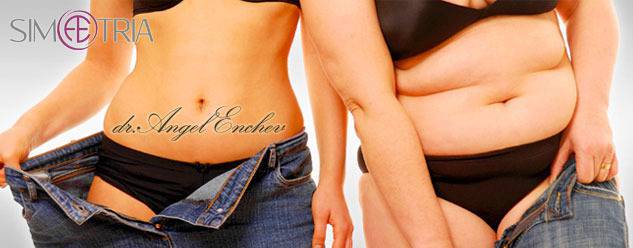 Болести от затлъстяването – Д-р Ангел Енчев, специалист по пластична хирургия и наднормено тегло