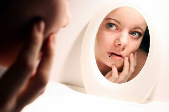 Фототерапия помага при витилиго