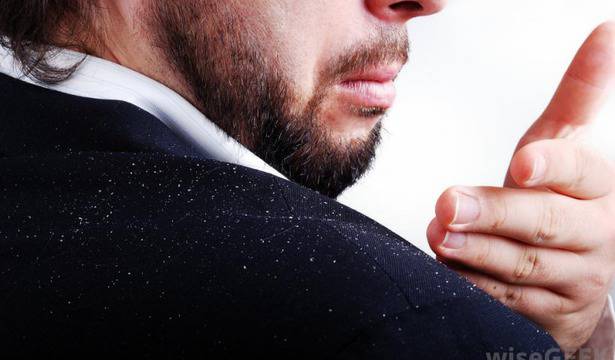 проблем с пърхот, мазен пърхот, себорея, премахване на пърхот, ампили против пърхот, лосион против пърхот