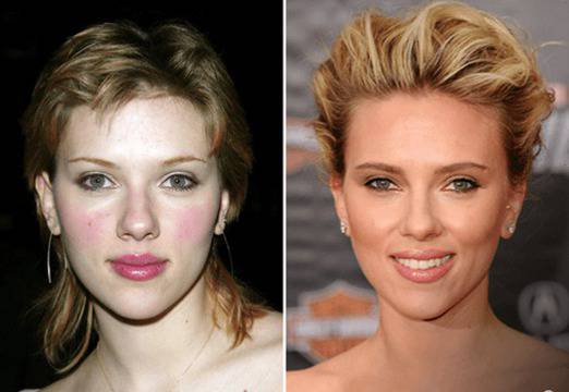 Възможно ли е формата и големината на носа да влияе на кариерата – Пластична хирургия д-р Ангел Енчев