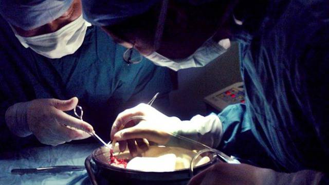 Китайски трансплантолози признават за отнемане на органи от привърженици на Фалун Дафа