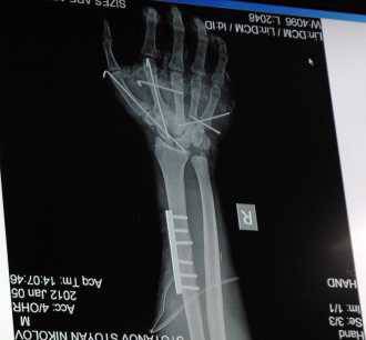 Безплатни прегледи при ортопед