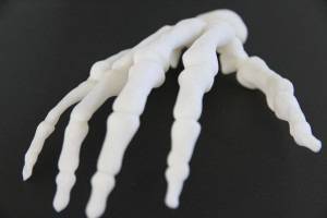 3D принитране в медицината