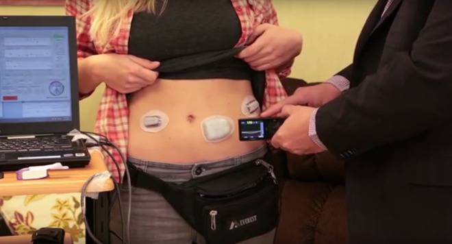 Българин с уникално откритие: Изкуствен панкреас, който ще помогне на болните от диабет