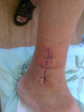 ГЕОРГИЙ КАРАДЖОВ: Как бивш „бачкатор“ е успял да се избави от артрита и остеохондрозата за един месец