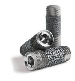 Зъбни импланти. София. Кога и как се поставят зъбени импланти ?