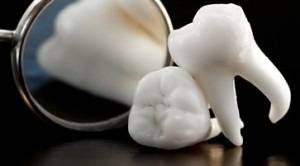 Вадене на зъб без страх от болка за пациента