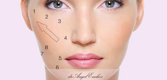 8-точков фейслифт – Пластична хирургия д-р Ангел Енчев – Неоперативна техника, инжектиране на филъри в областта на лицето